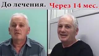 № 942. Клип о Российском методе RANC и Клинике 