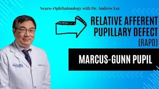 RAPD, Relative Afferent Pupillary Defect, Marcus-Gunn pupil