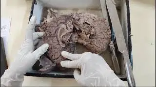 Brain -sectioning and surfaces