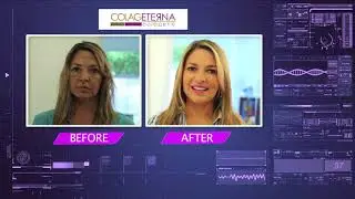 Colageterna
