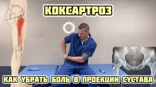 Как убрать боль в тазобедренном суставе?! Коксартроз. Самопомощь в домашних условиях. Миопрессура