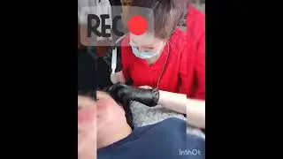 Холодная плазма. Лечение алопеции.