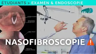 Comment réaliser une Nasofibroscopie | Formation étudiant ORL