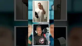 Man Spends Over $45K on Plastic Surgery😳💰… Plastic Surgeons React!