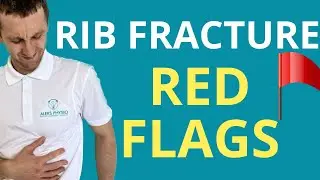 Rib Fracture: 3 Serious Complications To Watch For | Aleks Physio