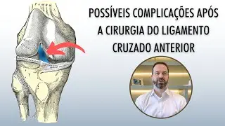 Cirurgia do Ligamento Cruzado Anterior - Como Lidar com Possíveis Complicações