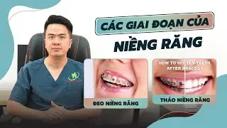 WHAT STAGES WILL BRACES GO THROUGH?