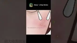 Right way to pop your pimples! ASMR pimple popping animation