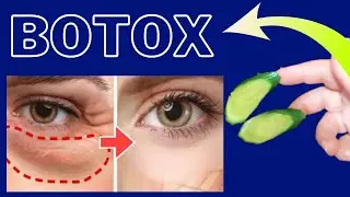 With the Astringent Effect of Cucumber, Wrinkles Around the Eyes Disappear Even at the Age of 65!