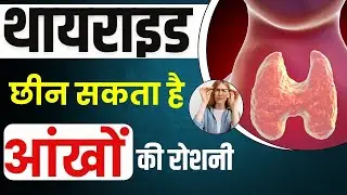 थायराइड आंखो के लिए है खतरा, जानें कारण और बचाव के उपाय ।  Thyroid eye disease | #thyroid