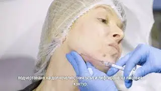 Филъри за контур на долна челюст