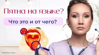 Пятна на языке? Что это и от чего?