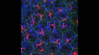 Three-dimensionally reconstructed images of immunostaining of the mouse ear epidermal sheet (Part 1)
