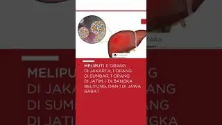 Kemenkes bicara tentang hepatitis akut