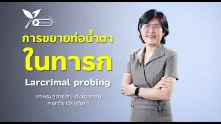 การขยายท่อน้ำตาในทารก ( Lacrimal probing)