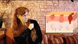 Нравится ли вашему телу загорать? Часть 2 (Перевод РЖЯ)