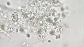 Ciliates