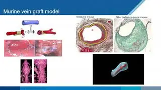 January 2021: Vascular remodeling imaging of murine vein grafts using high frequency ultrasound