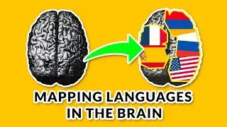 Languages and Awake Craniotomies: Mapping a Multilingual Brain
