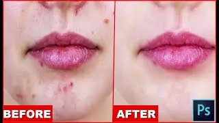 How to Remove Acne in Photoshop | Graphics Vocabulary | Adobe Photoshop 2020