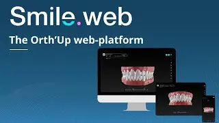 Smile.web | Web viewer for clear aligners treatment plans