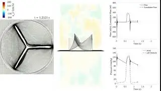 M2 Aortic valve simulation, physiological pressure slice view real time