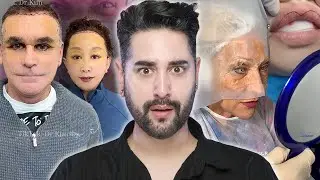 The Terrifying Facelifts Of Surgeon Dr Kim 😱