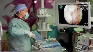 RIWOspine full-endoscopic spine surgery performed by Dr. Winkler Poland