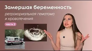 История моей замершей беременности (часть 2). Ретрохориальная гематома и кровотечения
