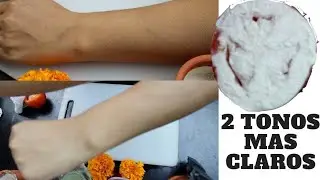 ACLARA TU PIEL CON SOLO 3 INGREDIENTES, RÁPIDO Y FÁCIL, RESULTADOS INCREÍBLES!!!