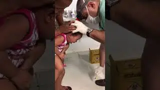 Otorrino tira moeda do esôfago da criança