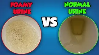Foamy Urine vs. Normal Urine: What’s the Difference?