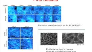 Multiphoton microscopy to study ocular properties - Jorge Lamela