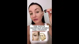 Как убрать мешки под глазами