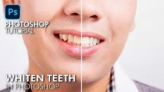 How to Easily Whiten Teeth in Photoshop