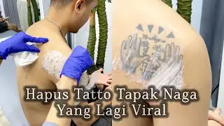 Hapus Tatto Tapak Naga Yang Lagi Viral