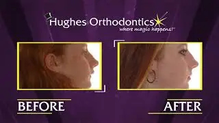 Custom Content Example: Orthodontic Before & After