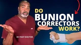 Do Bunion Correctors and Splints Work?