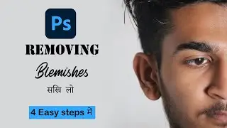 Photoshop tutorial - How to Remove Blemishes and scares in photoshop in 4 easy steps