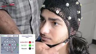 What is Neurofeedback system?