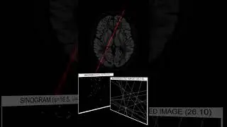 PET sinograms & backprojection