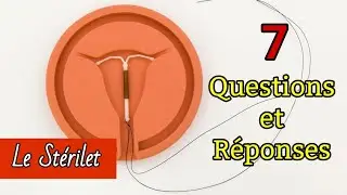 Stérilet : Tout ce que vous devez savoir sur le DIU : vos questions, répondues