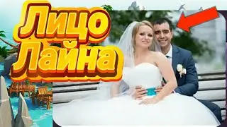 Лицо Лайна!После этого Лайн перестанет скрыватся)