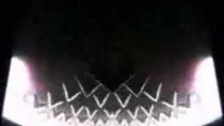 Scratchitbit  Beat by Beat video