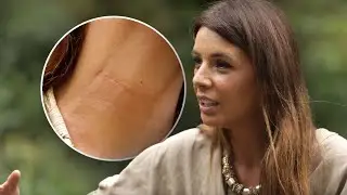 Evo gde je i šta radi Anđela Lakićević, našli smo je posle 2 godine: Imala ozbiljnu operaciju