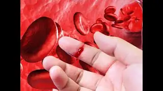 Blood Part 2