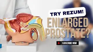 Rezum Water Vapor Therapy For Enlarged Prostate: What You Need to Know | Dr. Premal Patel