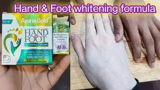 Whitening cream /Formula cream for whitening |Sandal cream & Arena gold cream |whitening capsule