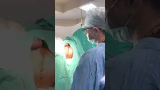 Fistula in ano Spreading in Scrotum and testes ANO-SCROTAL  Fistula with Abcess  How fistula spreads