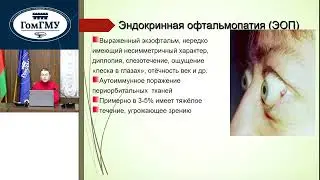 Махлина Е.С. Заболевания щитовидной железы